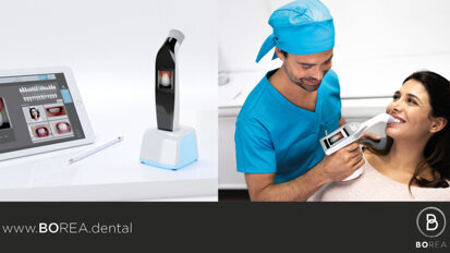 BOREA lève 1,5M€ pour accélérer la commercialisation de son Rayplicker