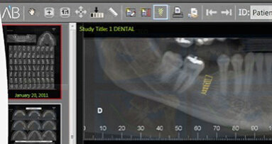 Low-price implants gaining interest
