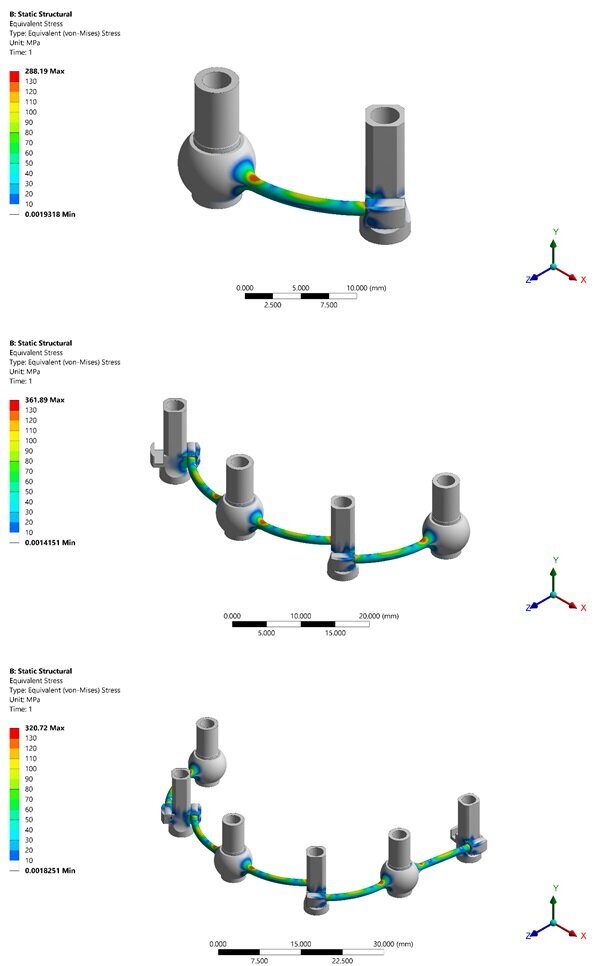 Fig. 2 - Un esempio di simulazione attraverso modelli matematici dei carichi, rappresentati con una scala colorimetrica, cui sono sottoposti i componenti utilizzati nell’applicazione della tecnica OkSplint nelle tre configurazioni “All on Two”, “All on Four” e “All on Six”. Simulazioni di questo tipo permettono di valutare con precisione, e già in fase di progettazione, la resistenza delle strutture che saranno prodotte al fine di assicurare che le stesse possiedano ampi margini di tolleranza alle sollecitazioni meccaniche cui saranno sottoposte una volta realizzate, e siano quindi intrinsecamente sicure.