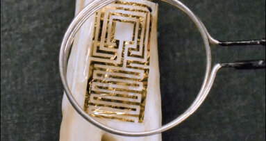 用于牙齿上的新型生物传感器