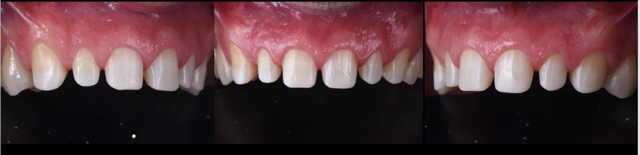 Obr. 10a–c: Po preparaci