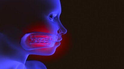 Opleiding kaakchirurgie fors duurder