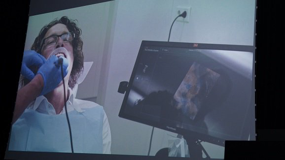 Colocan corona impresa en 3-D a CEO