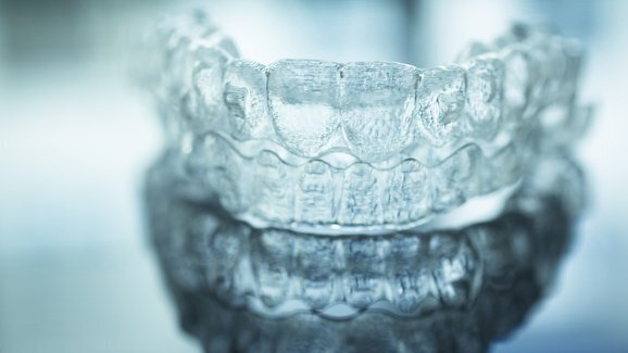 Пазарът на невидими алайнери ще продължава да расте в следващите 5 години