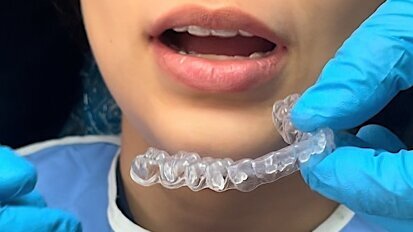 Video blanqueamiento