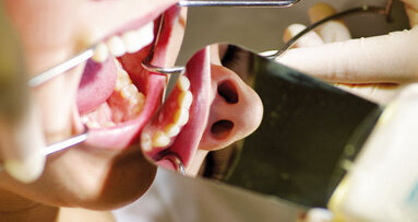 Einsatz eines beschlagfreien Intraoralspiegelsystems