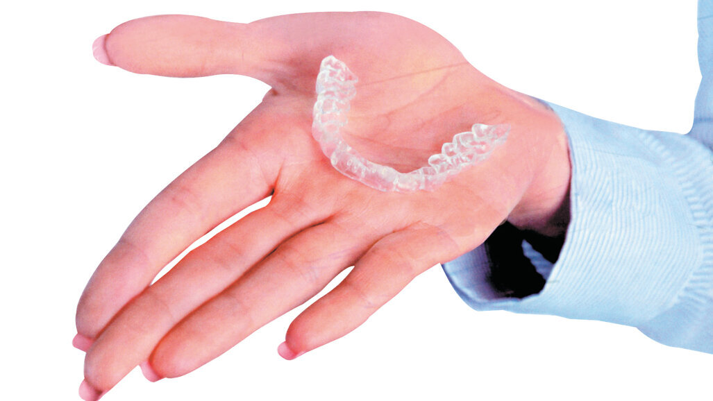 Οι διαφανείς νάρθηκες αποδεικνύονται πιο επωφελείς από τα ορθοδοντικά άγκιστρα