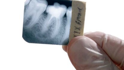 Carestream Health podwyższa ceny filmów do badań  radiologicznych