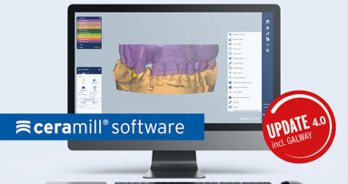 Amann Girrbach optimiza todo el software de Ceramill