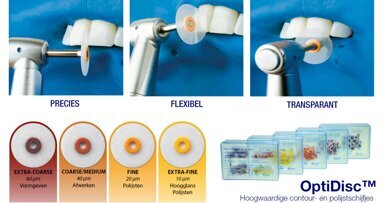 Testimonial Maarten de Beer: OptiDisc contour- en polijstschijfjes
