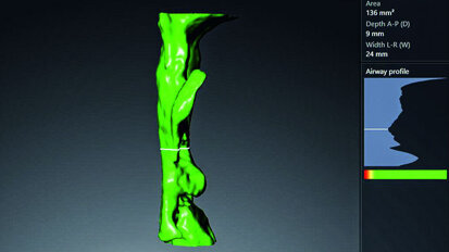 Il ruolo dell’Odontoiatria nella medicina del sonno