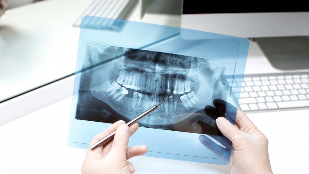 Ocena wieku na podstawie trzecich zębów trzonowych nie ma potwierdzenia naukowego