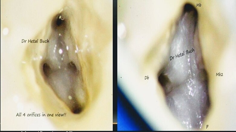 10 essential aspects for implementing magnification in your practice