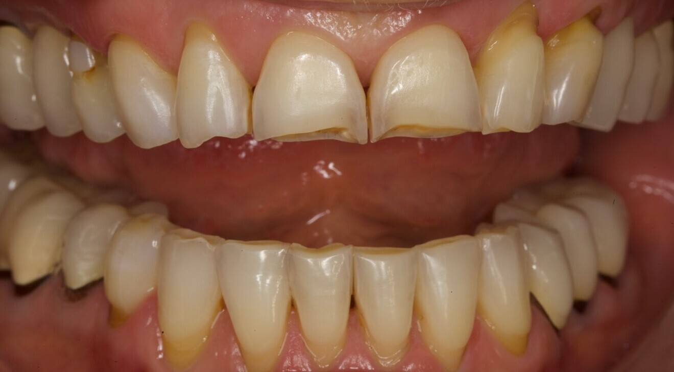 Fig. 1c: Frontal view.