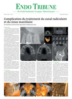 Endo Tribune France No. 2, 2020