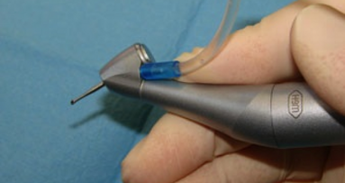 El primer contra-ángulo de 45 grados ofrece un acceso óptimo