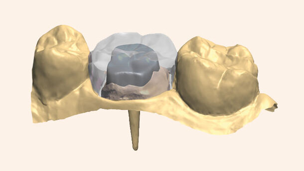 Solution de conception de pivots performante