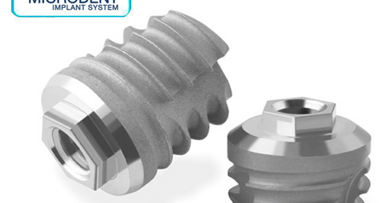 No hay evidencia de éxito a largo plazo de los implantes dentales