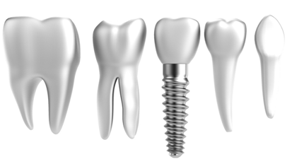 Zahnersatz: Dank Silber weniger Entzündungsreaktionen