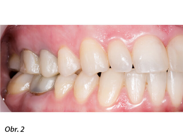 Počáteční klinická situace