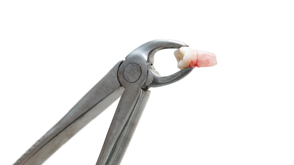 Boete voor Eurosmile wegens fraude