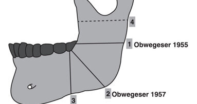 Orthodontic surgery and aesthetics