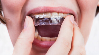 Three questions for Keith Batcheller, ClearCorrect