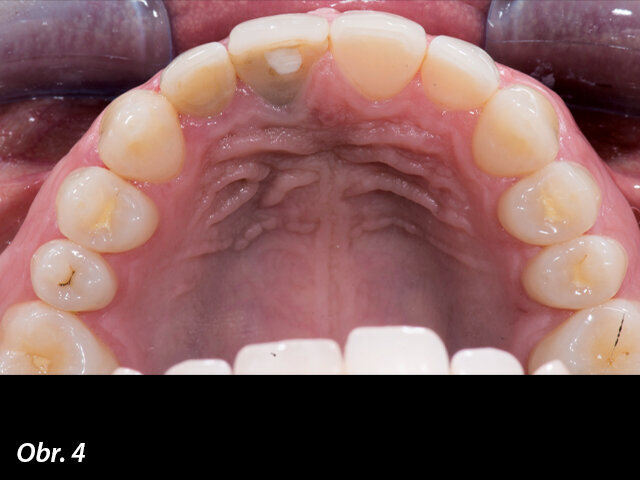 Výchozí stav u pacientky.