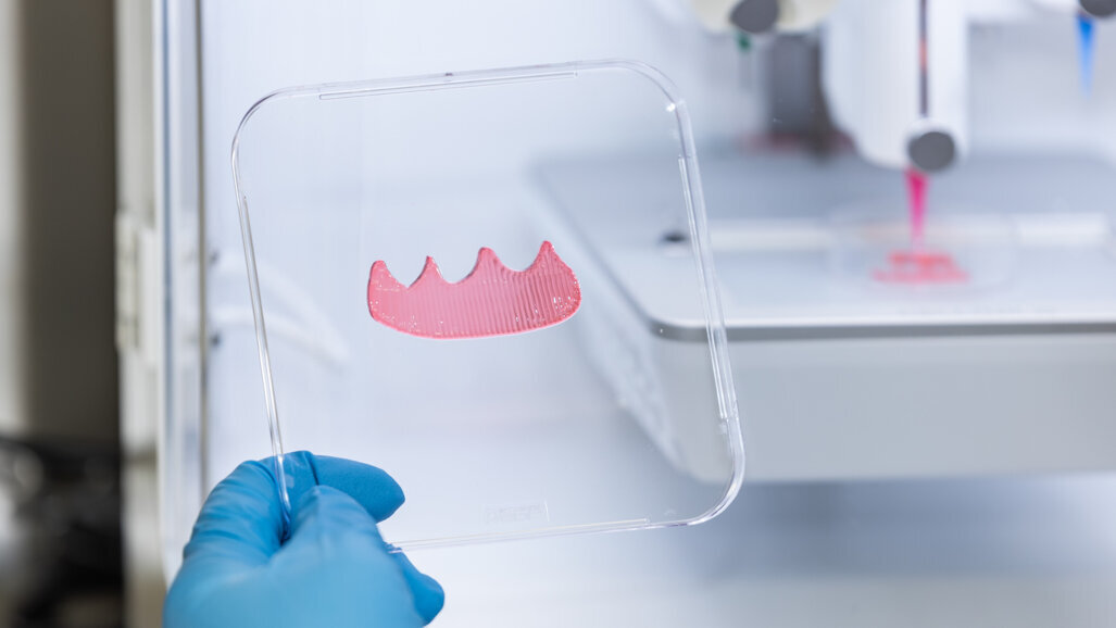AI-enhanced 3D bioprinting enables custom oral soft-tissue grafts