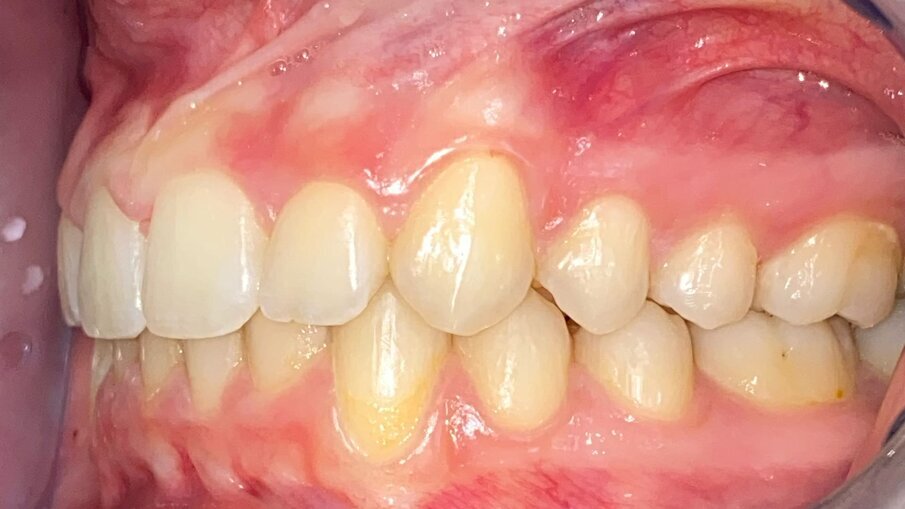 Fig. 20_Laterale sinistra post-trattamento.