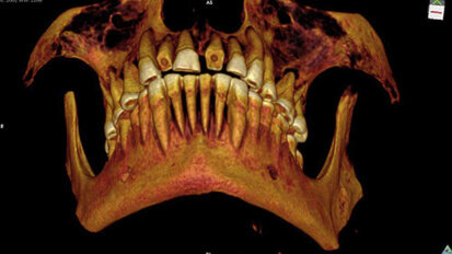 Mummie met gebit vol caviteiten ontdekt