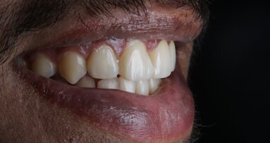 Ortho-Resto Continuum —An Interdisciplinary Approach: Case Report