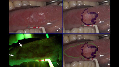 Goccles: 60 secondi possono salvare una vita