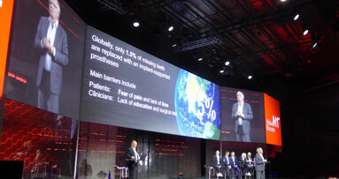 El nuevo sistema de implantes Nobel Biocare N1