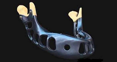 Soluciones en regeneración ósea