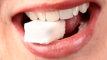 La malattia orale indotta da zucchero è la più onerosa per il sistema sanitario tedesco