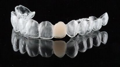 Contemporary provisionalisation with 3D printing: New approaches to familiar clinical challenges