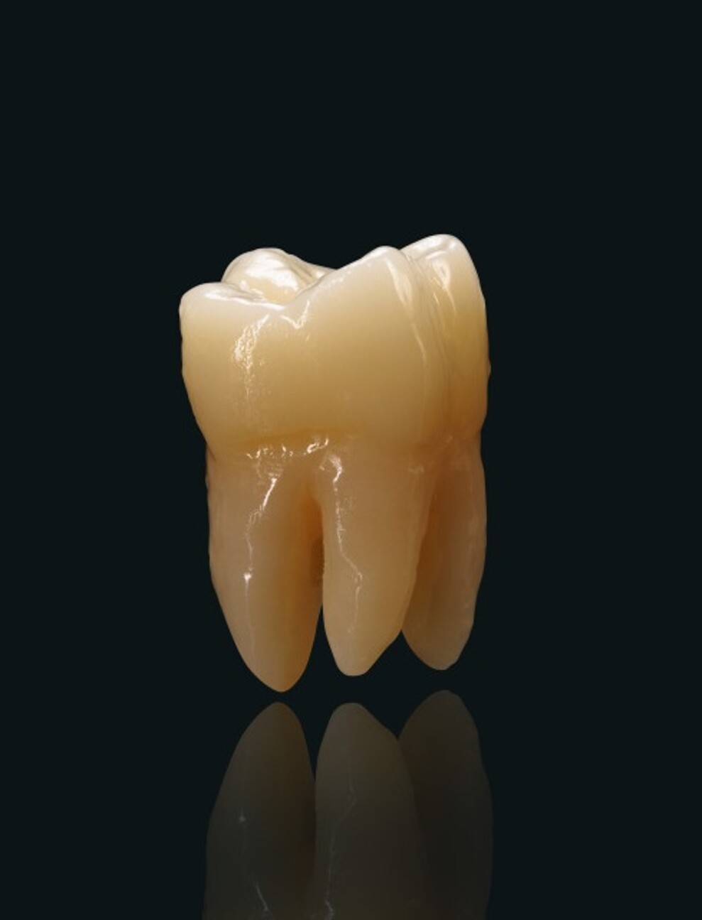 Zolid Lunaris restorations combine intensified chroma and high translucency to support shade consistency and reduce reworking.