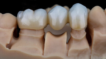 H3D seeks to remedy technician shortage with AI CAD for dental laboratories