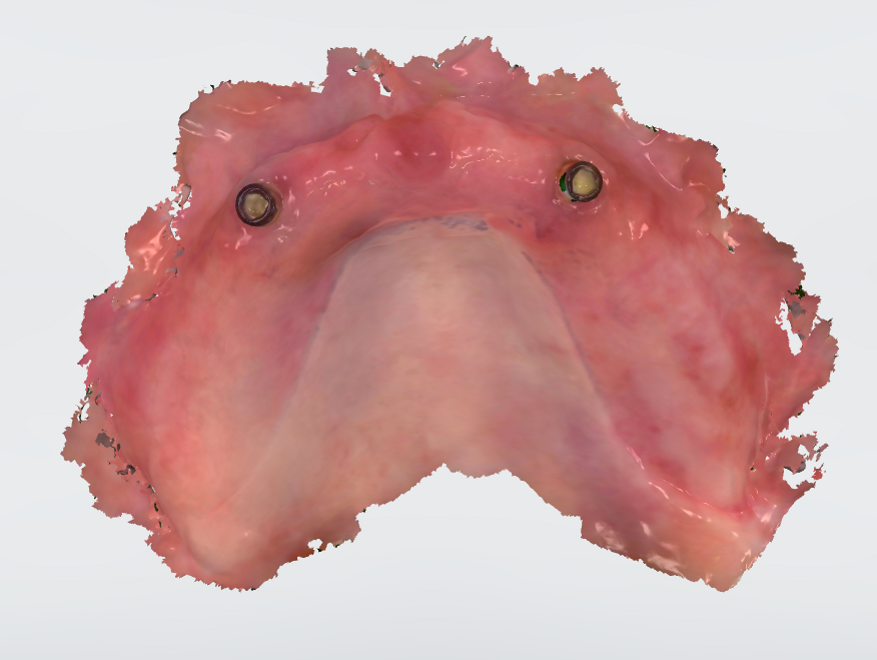 Fig. 7 - Scansione del mascellare superiore edentulo.