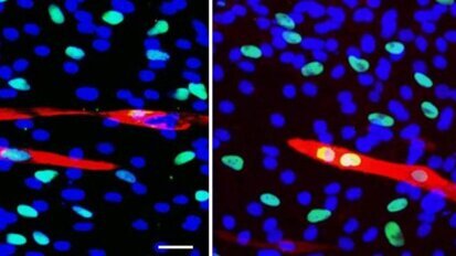 Les dentistes récoltent des cellules souches pour la médecine régénérative de l'avenir