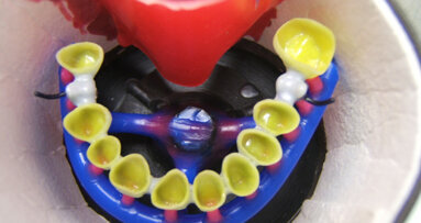 Interazioni tra i materiali di rivestimento per fusioni e leghe