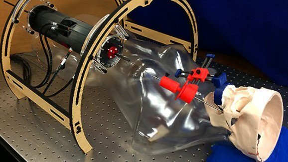 Hersenchirurgie via de wang