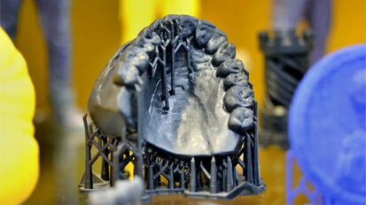 Πώς η τεχνολογία τρισδιάστατης εκτύπωσης και η γωνία εκτύπωσης επηρεάζουν την ακρίβεια των οδοντιατρικών εκμαγείων