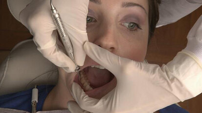 Cure antitumore: attenzione a bocca e denti