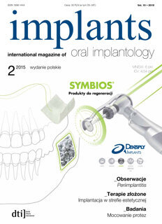 implants Poland No. 2, 2015