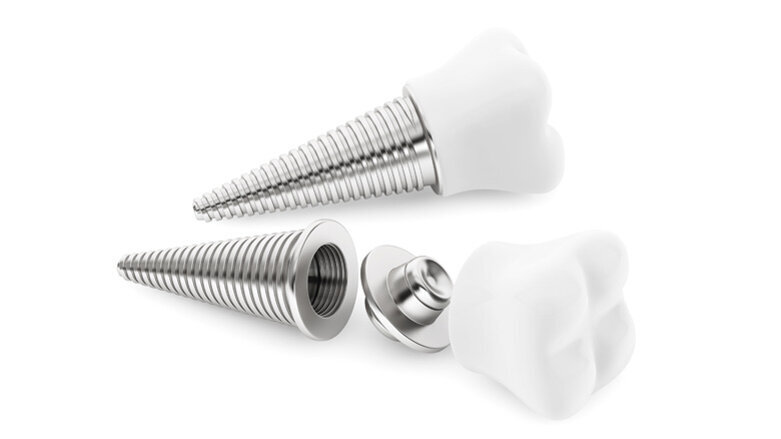 Mikrogewinde an Implantaten begünstigen Osseointegration