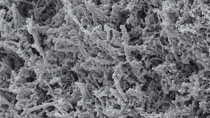 Projekt „MinOroBiome“ untersucht bakterielle Biofilme im Mund