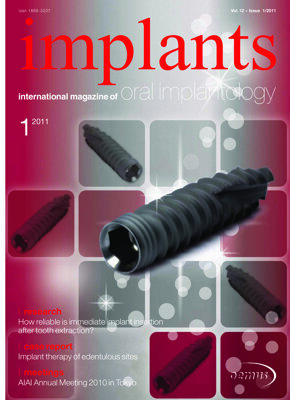 implants international No. 1, 2011 implants international No. 1, 2011