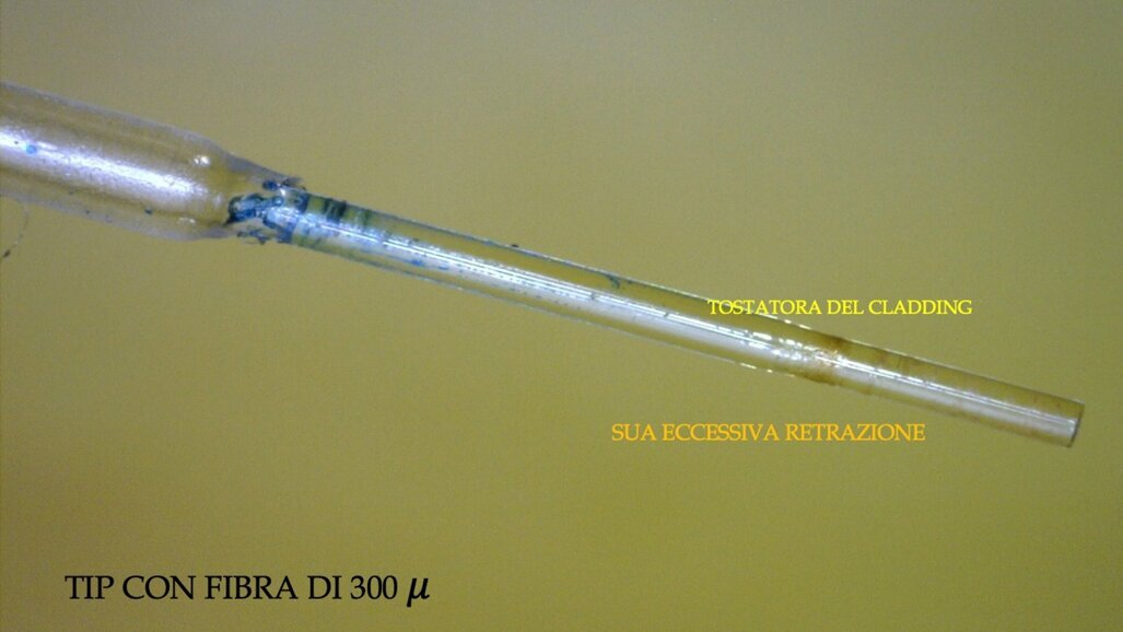 Attivazione della fibra del Laser a Diodo